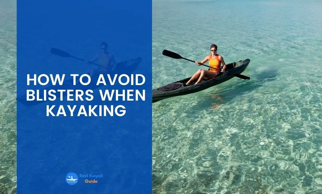 How to Avoid Blisters When Kayaking? Things You Need to Know About How to Avoid Blisters